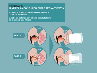Suavinex biberón Zero Zero Anticólicos talla U silicona flujo M 270 ml 